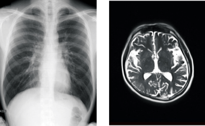 【「カルテコ」で閲覧できるようになる検査画像のイメージ】