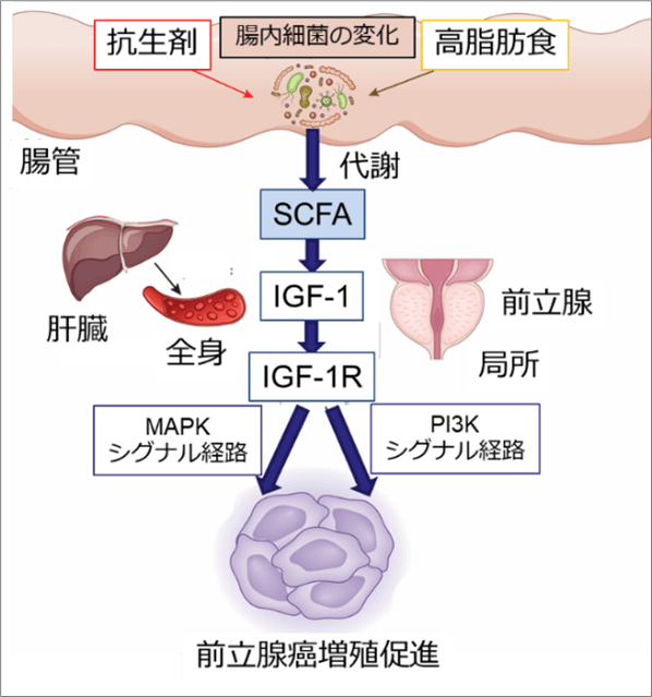 (図)前立腺がん増殖促進の仕組み