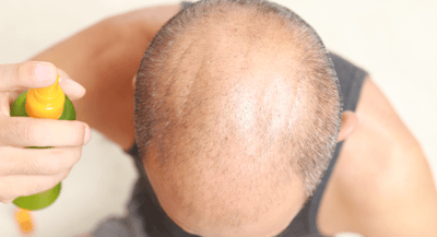 v059yPSgIDsqJ7s1vWcY.png?w=940&h=940