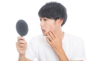 「ヒゲのお手入れ中に、埋没毛を発見！原因と対策は？」DANDY LABO.にて脱毛に関する記事を公開