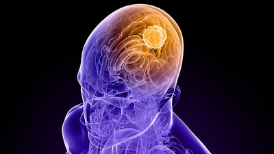 vGfB7z5i3u6bVYLMQaOJ.jpg?w=940&h=940