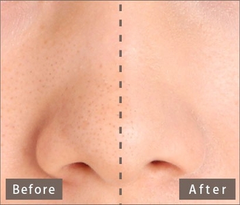 vH1gXERgvTSRP2y6K0pX.jpg?w=940&h=940