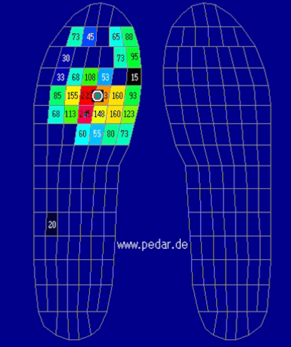 注釈:調査は足裏の圧力センサーを用いて画像のように負荷がかかる部分を確認しました