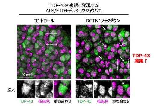 図3)DCTN1をノックダウンしたALS/FTDモデルショウジョウバエでは、本来は核に局在するはずのTDP-43が、細胞質で凝集・異常蓄積しているのが確認された。(緑はTDP-43、マゼンタは細胞の核を表す)(右写真の矢印がTDP-43の細胞質凝集)