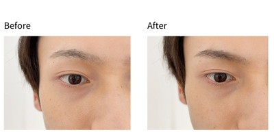 xndp9RV2T7Ev36L3kpYv.jpg?w=940&h=940