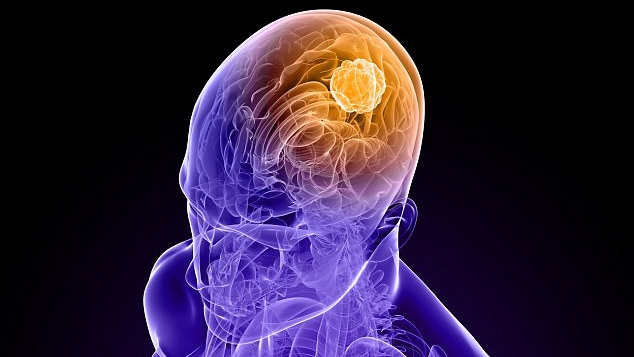 高悪性度神経膠腫の市場規模、分析、業界統計、最新の洞察(2033年まで)