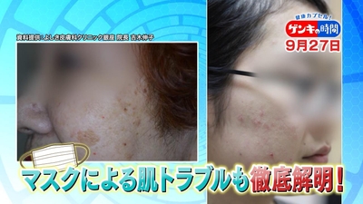 y5PBYTwQbU3c1fl6Yz4K.jpg?w=940&h=940