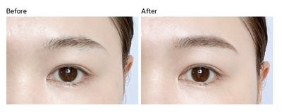 yNkCj74ws5tJOmf6i4yE.jpg?w=940&h=940