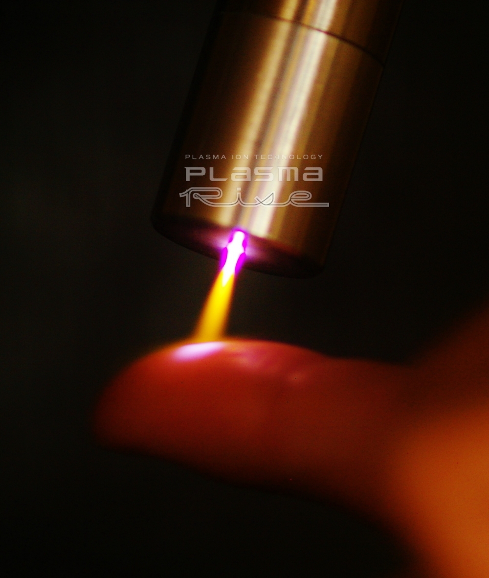 写真2.指にも照射できる低温プラズマ