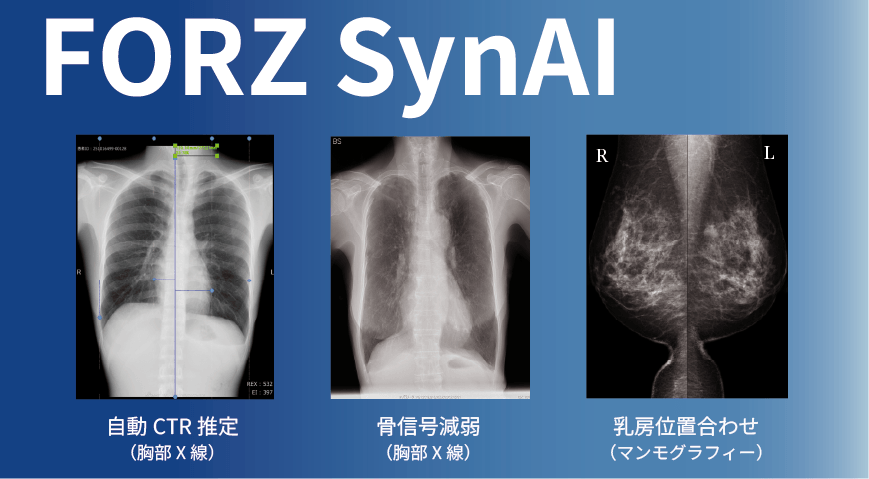 【医療DX】医師の負担を軽減。AI画像解析プラットフォーム「FORZSynAI」リリース