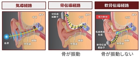 けいはんな学研都市に立地のCCHサウンドが 有線イヤホンの決定版・世界