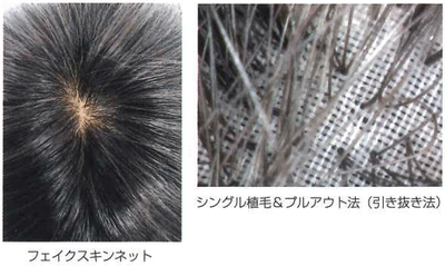 zGKRiS095CpLVB8QMxsx.gif?w=940&h=940