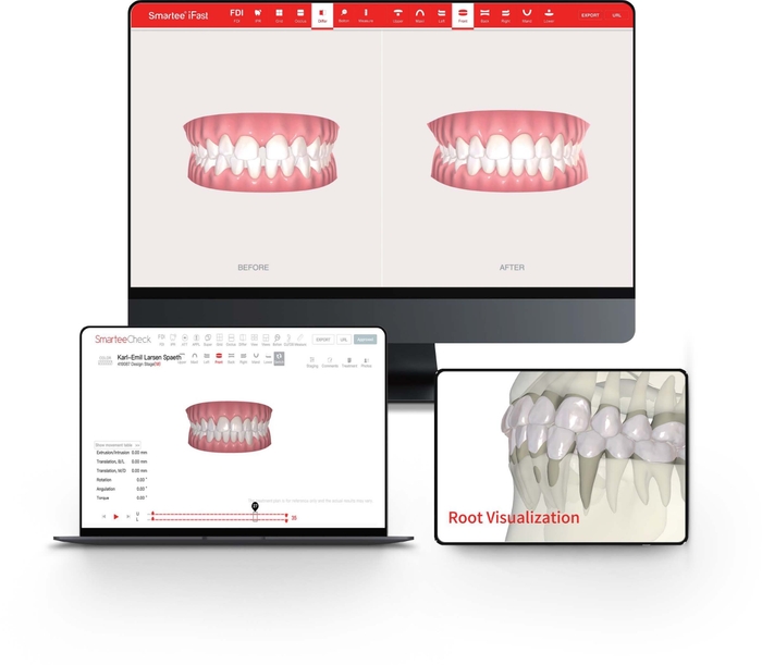 SmarteeのAI治療計画