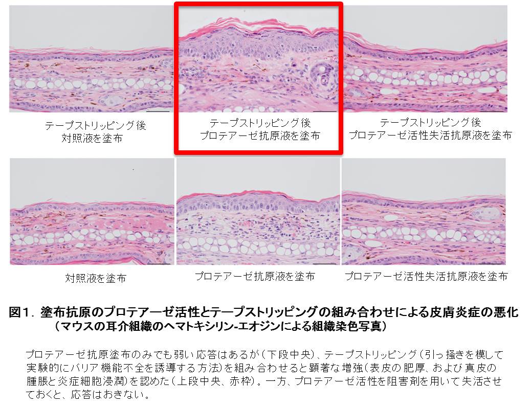 アレルゲン皮膚感作の新しい型を発見 学校法人順天堂のプレスリリース アレルゲン皮膚感作の新しい型を発見 学校法人順天堂のプレスリリース