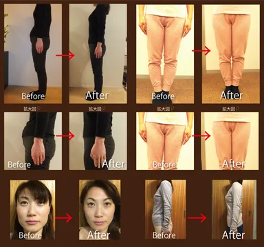 ビフォーアフター写真