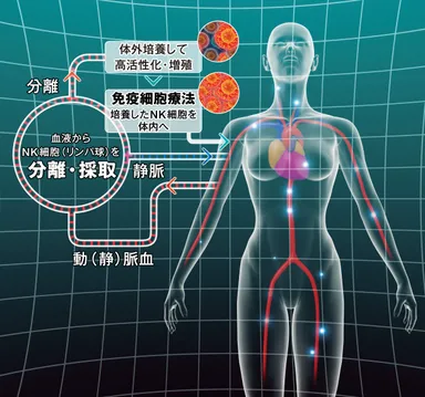 がん免疫細胞治療のしくみ