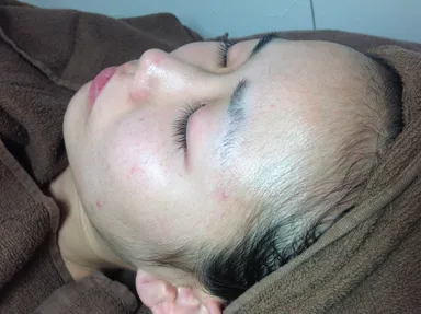 おでこの産毛ビフォー