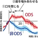 (b) ODS患者（赤線）と非ODS患者（青線）の脳活動の違い