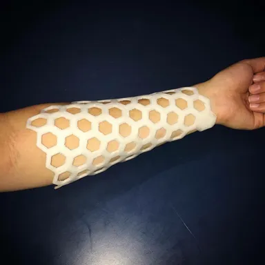 シートギプス　腕に巻いている画像