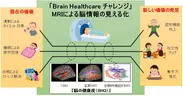 Brain Healthcare チャレンジ