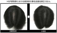 HGP摂取群における頭頂部の薄毛改善効果(2) Bさん