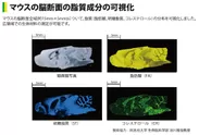 マウスの脳断面の脂質成分の可視化