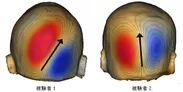 対象とした脳活動の信号源と電流方向(頭表に投影した視覚誘発磁界分布)