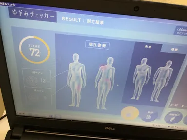 最新の歪みチェッカー