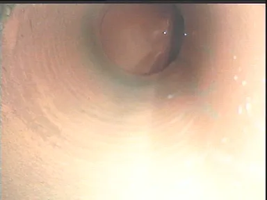 築27年の水道管の中(ライニング鋼管)