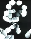「乳酸菌フェカリスFK-23」の顕微鏡写真
