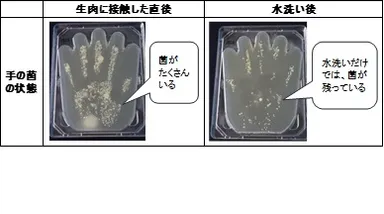 手の菌の状態