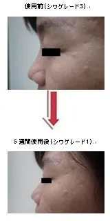 図1：被験者　効果例