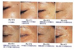 図2：シワグレード判定法　標準写真