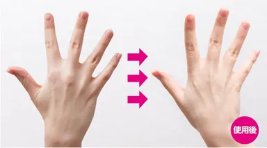 商品使用例(手の甲)