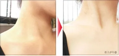 商品使用例(首回り)