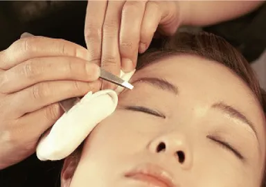 ツィーザー処理