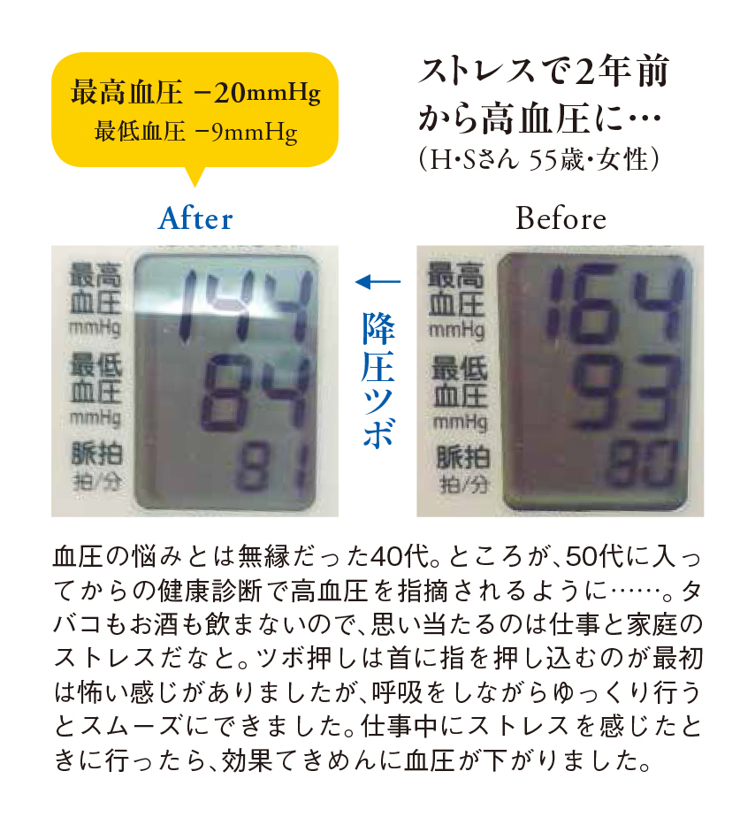 血圧 下げる 方法 で 即効 を 即効で血圧を下げる２つの方法｜高血圧の種類・原因・注意点も解説