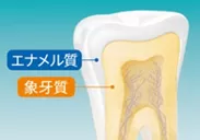 【参考】エナメル質と象牙質の関係