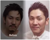 Before after 2