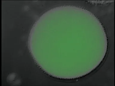 カルシウム波の蛍光画像