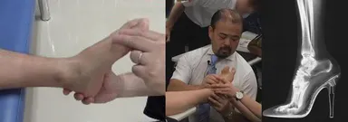 リアライン・フット 2