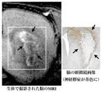生体で撮影された脳のMRI・脳の顕微鏡画像