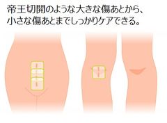 アトレスケア 使用イメージ