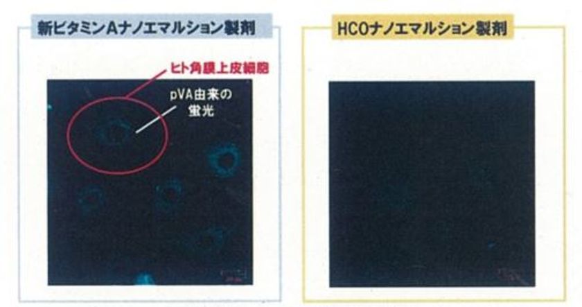 「ビタミンA」を配合した新たな点眼薬による
ドライアイ患者への有効性向上を発見