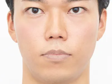 D：唇が荒れている男性