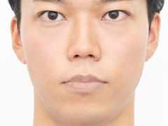 D：唇が荒れている男性