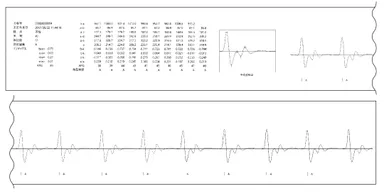 印刷：測定波形