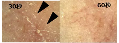 小鼻部分のメイク残り