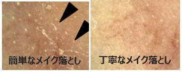 小鼻部分メイク残りの肌の例