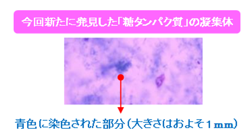 岡山大学大学院と成人の尿成分を研究　
健康な人の尿に1mmを超える不純物(※1)がある事を新発見
